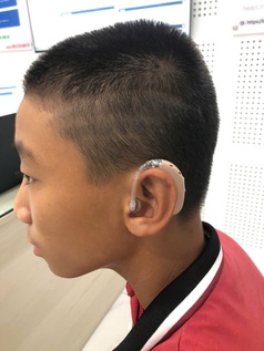 Máy trợ thính Phonak Sky Lumity - máy trợ thính dành riêng cho trẻ em 
