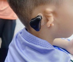 Máy trợ thính đường xương med-el adhear 