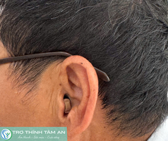 Máy trợ thính nhỏ gọn, kín đáo trong tai 