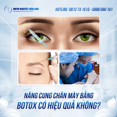 Nâng cung chân mày bằng botox 