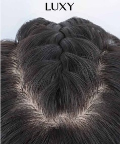Tìm hiểu tóc giả che hói đỉnh đầu nam 