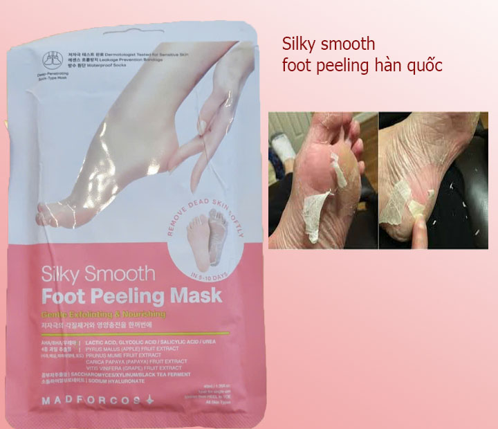 3 Chia sẻ kinh nghiệm lột da bàn chân  Foot Peeling