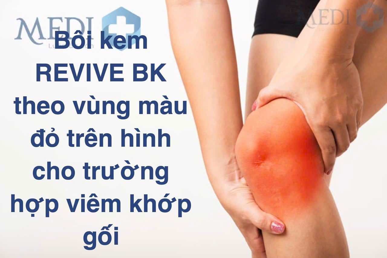 2 Kem PHỤC HỒI Cơ Xương KHớp - ĐH Bách khoa Hà Nội 2 Kem PHỤC HỒI Cơ Xương KHớp - ĐH Bách khoa Hà Nội