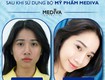 Hyalu b5 cream    kem siêu dưỡng ẩm da  được mong chờ...