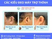 Các kiểu deo máy trợ thính tại trợ thính tâm an nam định 