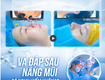 Va đập sau nâng mũi 