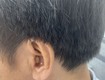 Máy trợ thính trong tai   Máy trợ thính CIC 