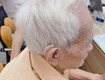 Mất thính lực có thể tiến triển nhanh như thế nào 