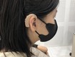 Suy giảm thính lực ở mọi lứa tuổi 