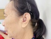 Máy trợ thính thanh hóa,trợ thính tâm an. 