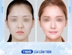 Cằm tròn đầy: Biểu tượng cuộc sống giàu sang viên mãn 