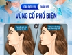 Các dịch vụ liên quan đến thẩm mỹ vùng cổ