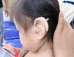 Máy trợ thính tốt cho trẻ nhỏ có tại thanh hóa.