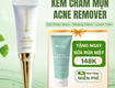 Kem trị mụn renoskin acne remover 