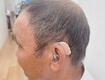 Máy trợ thính chính hãng 
