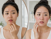 Vì sao da càng skincare nhiều lại càng dễ châm chích