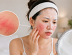Da khô căng dù dưỡng ẩm đầy đủ có thể liên quan đến hàng rào...