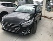 Hyundai accent trả góp, chỉ 150 triệu giao xe ngay