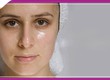 5 Bước Skincare trị mụn cho da dầu hiệu quả nhất 