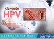 Góc chia sẻ   chi phí xét nghiệm sùi mào gà 