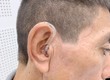 Tại sao cần đeo máy trợ thính sớm khi bị nghe kém 