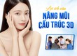 Lợi ích của phương pháp nâng mũi cấu trúc 3D 