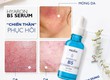 Serum dưỡng phục hồi da cao cấp   Hyaron B5 Mediva 