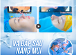 Va đập sau nâng mũi 