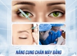 Nâng cung chân mày bằng botox 