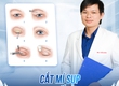 Cắt mí có thay đổi vận mệnh không 
