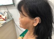 Đeo máy trợ thính   có nghe lại như bình thường không 
