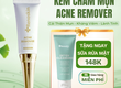 Kem mụn Acne Remover Renoskin 10ml   Giảm Mụn, Mờ Thâm Mụn 