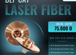 Bép cắt laser E   type 