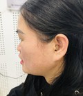 Máy trợ thính trong tai cic 
