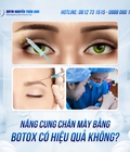 Nâng cung chân mày bằng botox 