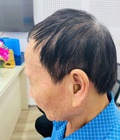 Máy trợ thính siêu nhỏ trong tai CIC 