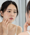 Kem chống nắng bị vón khi kết hợp với skincare: Cơ chế và cách hạn chế 