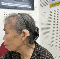 2 Những loại mất thính lực nào trở nên tồi tệ hơn theo thời gian