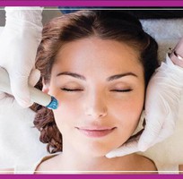 Địa chỉ trị sẹo rỗ ở đâu tốt nhất TPHCM hiện nay bạn đã biết