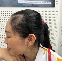 1 Máy loa trong tai thế hệ mới ReSound Key