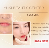 Tiêm Filler Môi Đà Nẵng tại Thanh Yuki Beauty Center