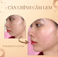 2 Tiêm Filler Môi Đà Nẵng tại Thanh Yuki Beauty Center