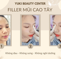 1 Tiêm Filler Môi Đà Nẵng tại Thanh Yuki Beauty Center