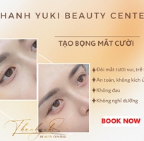 5 Tiêm Filler Môi Đà Nẵng tại Thanh Yuki Beauty Center