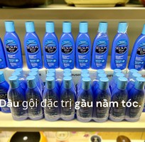 4 Loại Dầu Gội Selsunblue