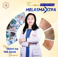 1 Trị nám số 1 tại tp.HCM - Spa Thẩm Mỹ viện Lê Hoài