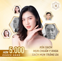 5 Trị nám số 1 tại tp.HCM - Spa Thẩm Mỹ viện Lê Hoài