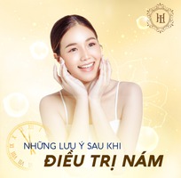 3 Trị nám số 1 tại tp.HCM - Spa Thẩm Mỹ viện Lê Hoài