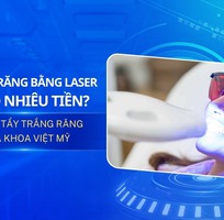 Tẩy trắng răng bằng laser giá bao nhiêu tiền hiện nay