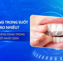 Niềng Răng Trong Suốt Giá Bao Nhiêu  Tìm Hiểu Ngay